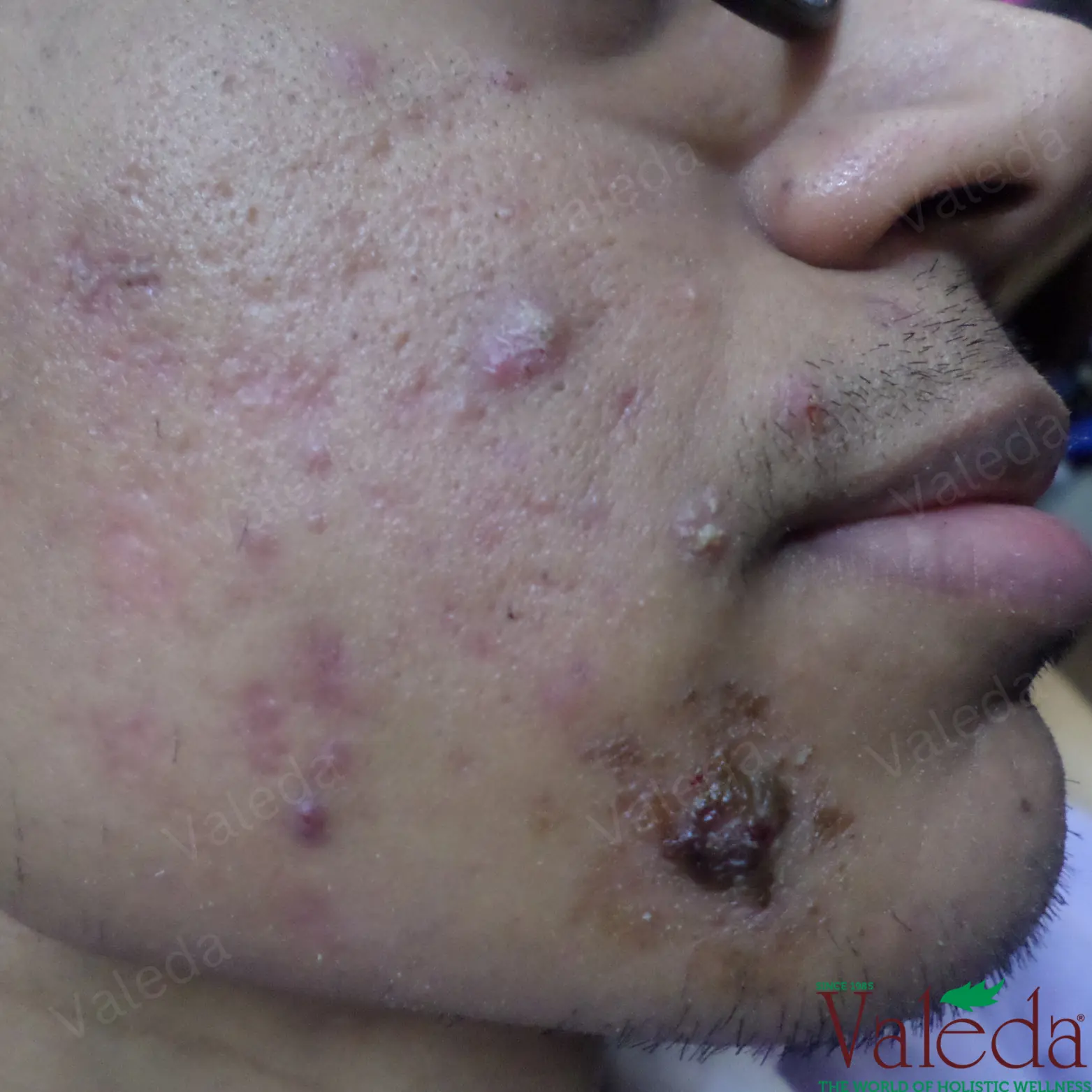Clinical photograph 2