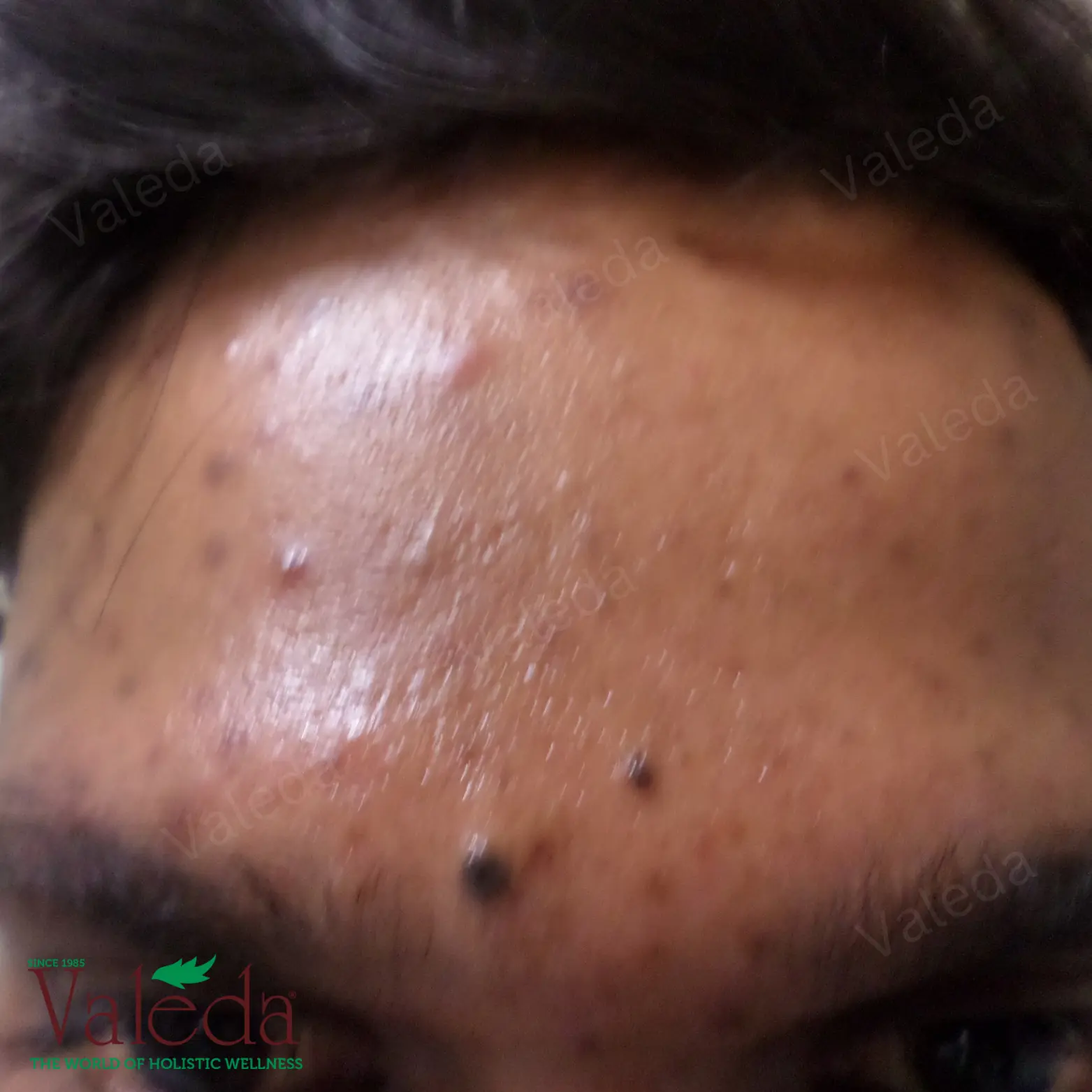 Clinical photograph 4