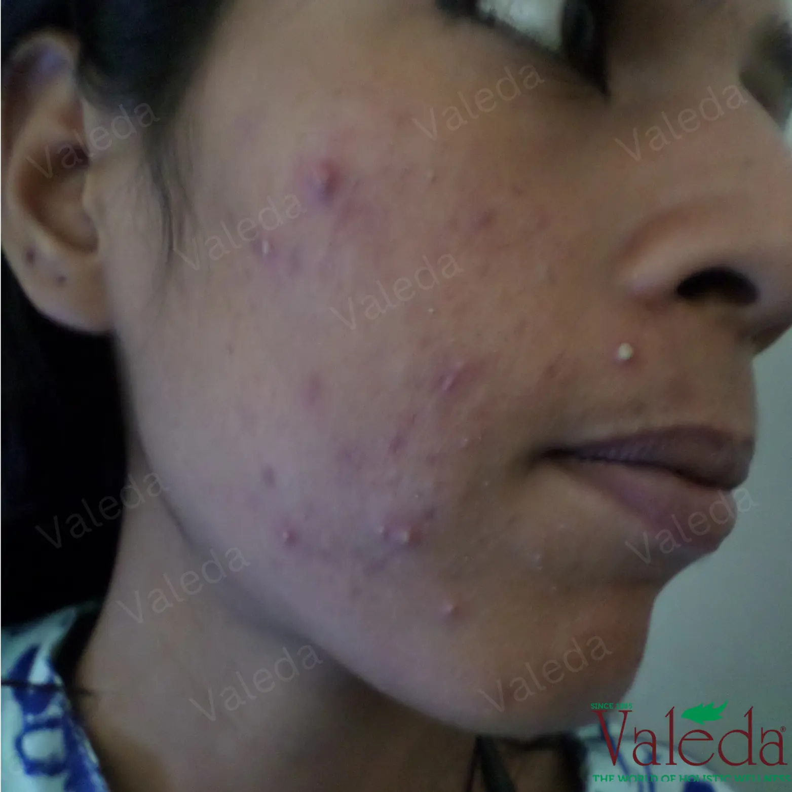 Clinical photograph 5