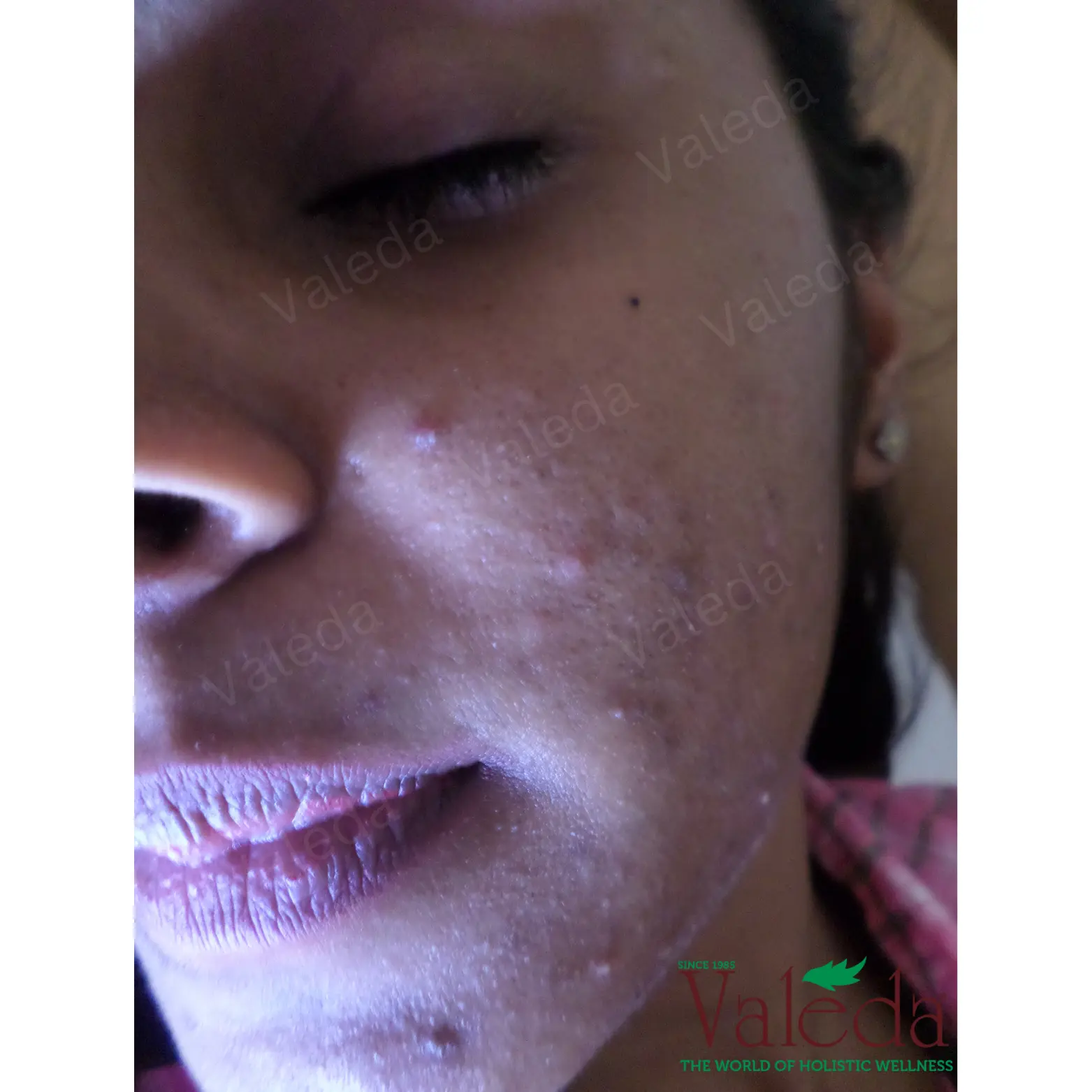 Clinical photograph 6