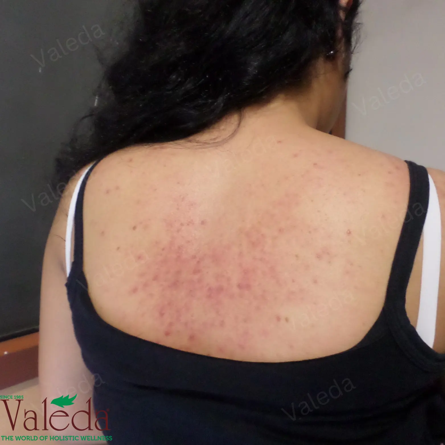 Clinical photograph 7