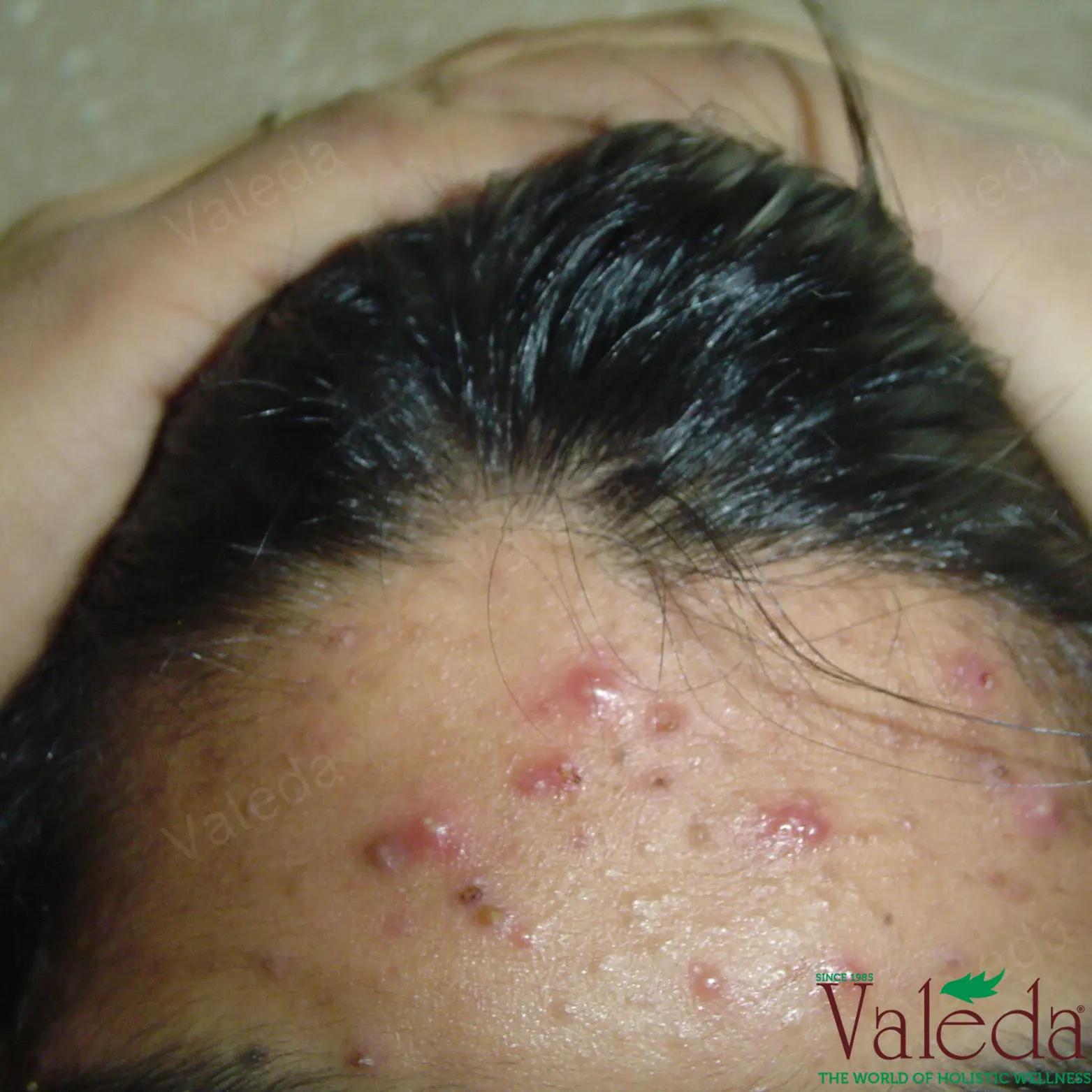 Clinical photograph 8
