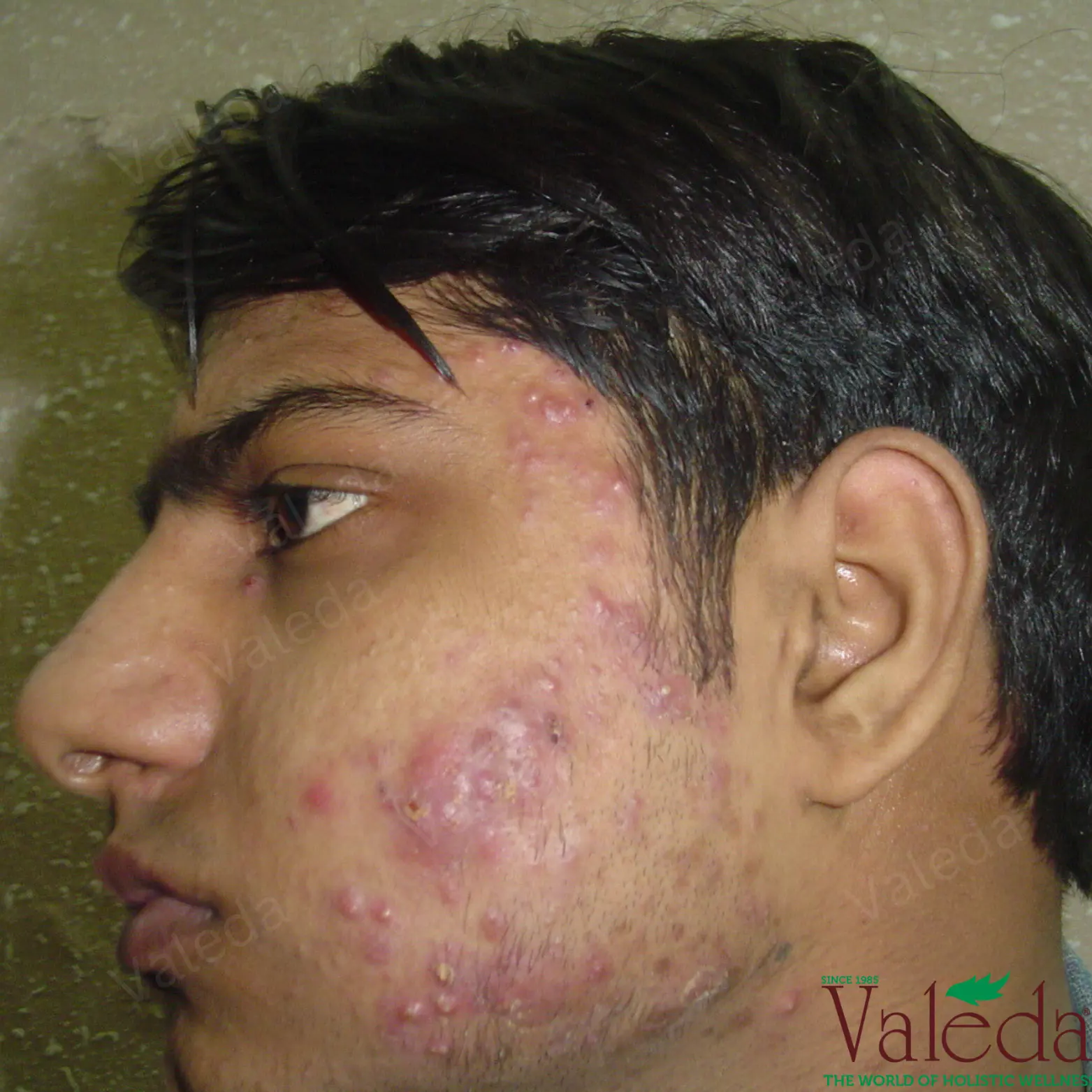 Clinical photograph 9