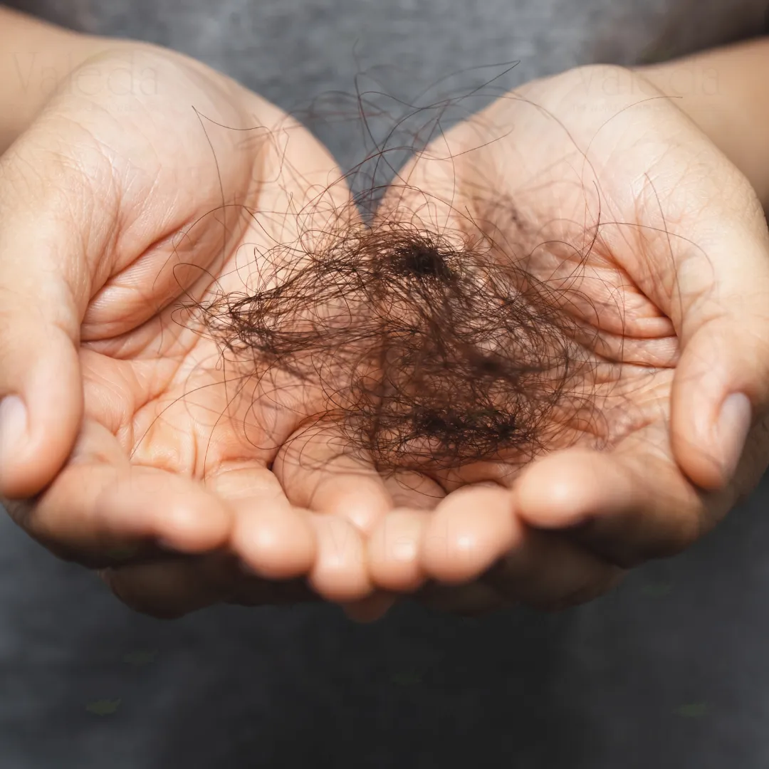 Men's Hair Loss