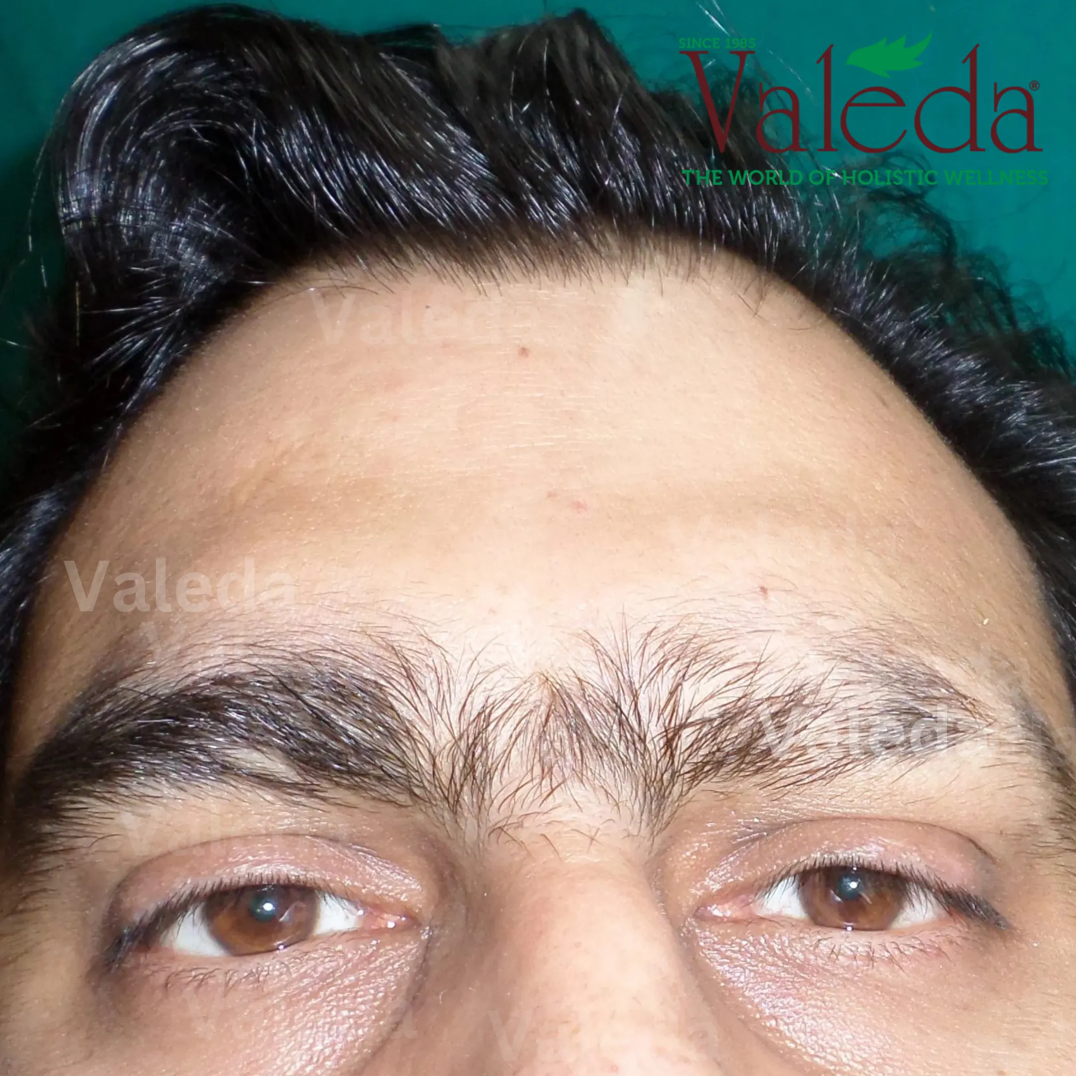 Clinical photograph 1