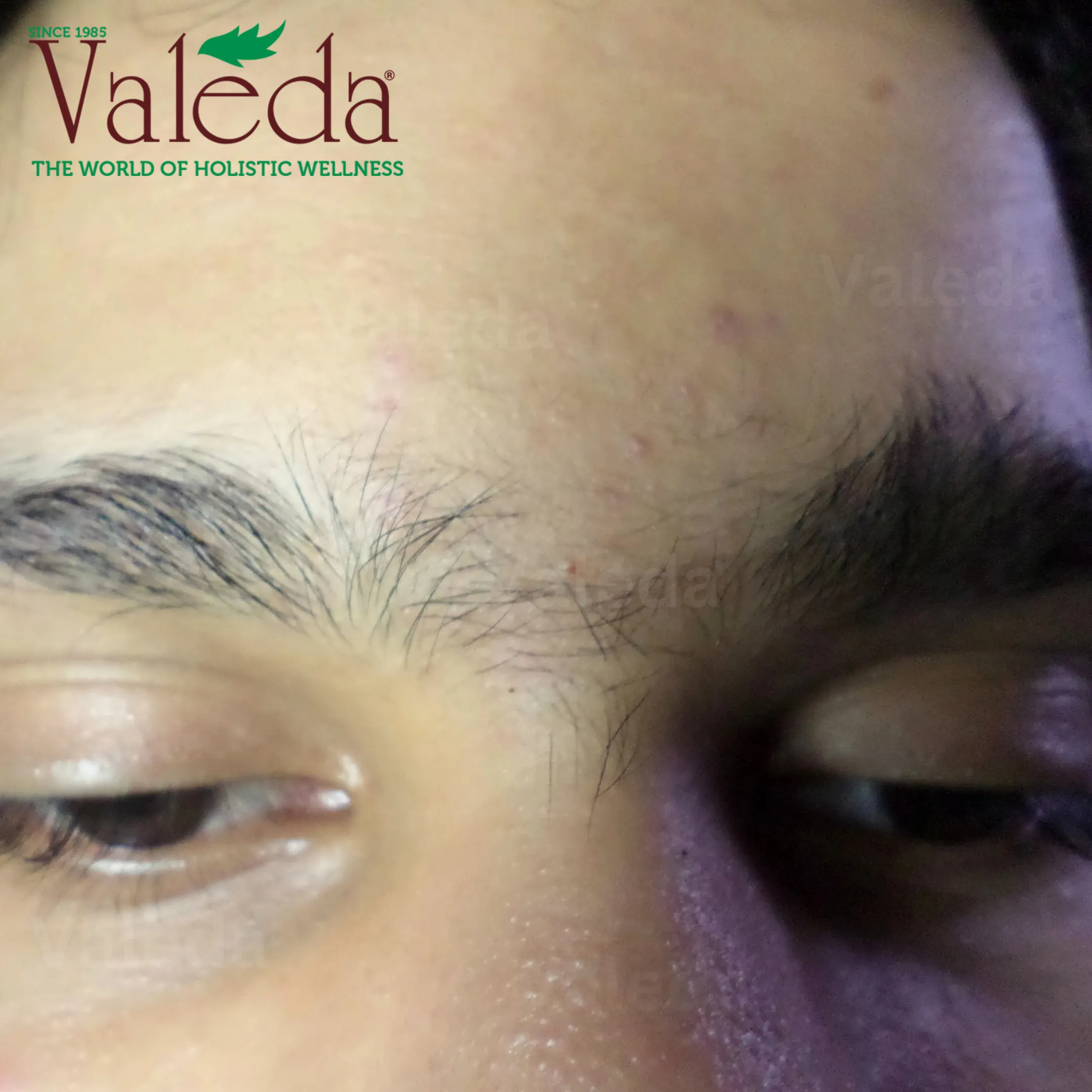 Clinical photograph 2