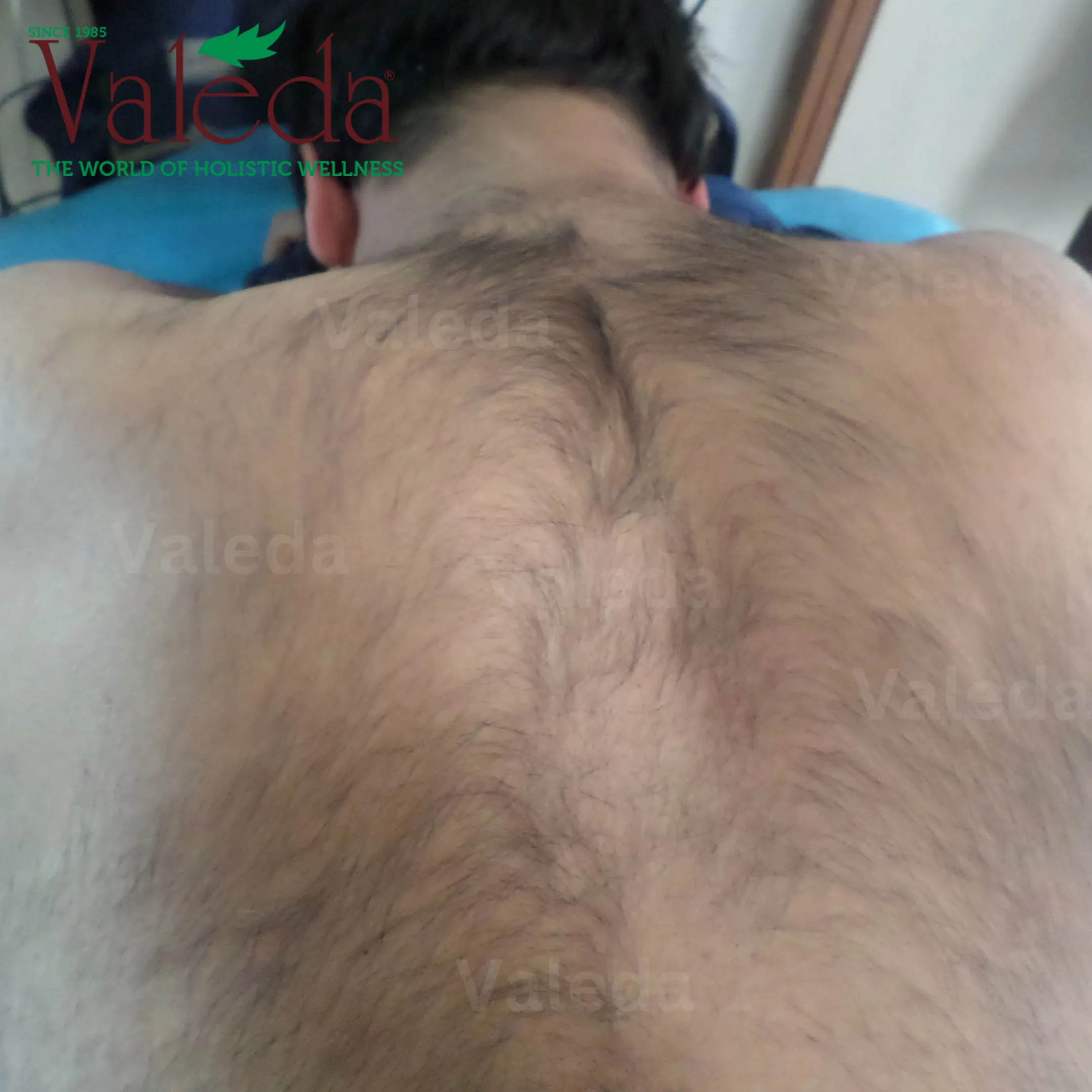 Clinical photograph 3
