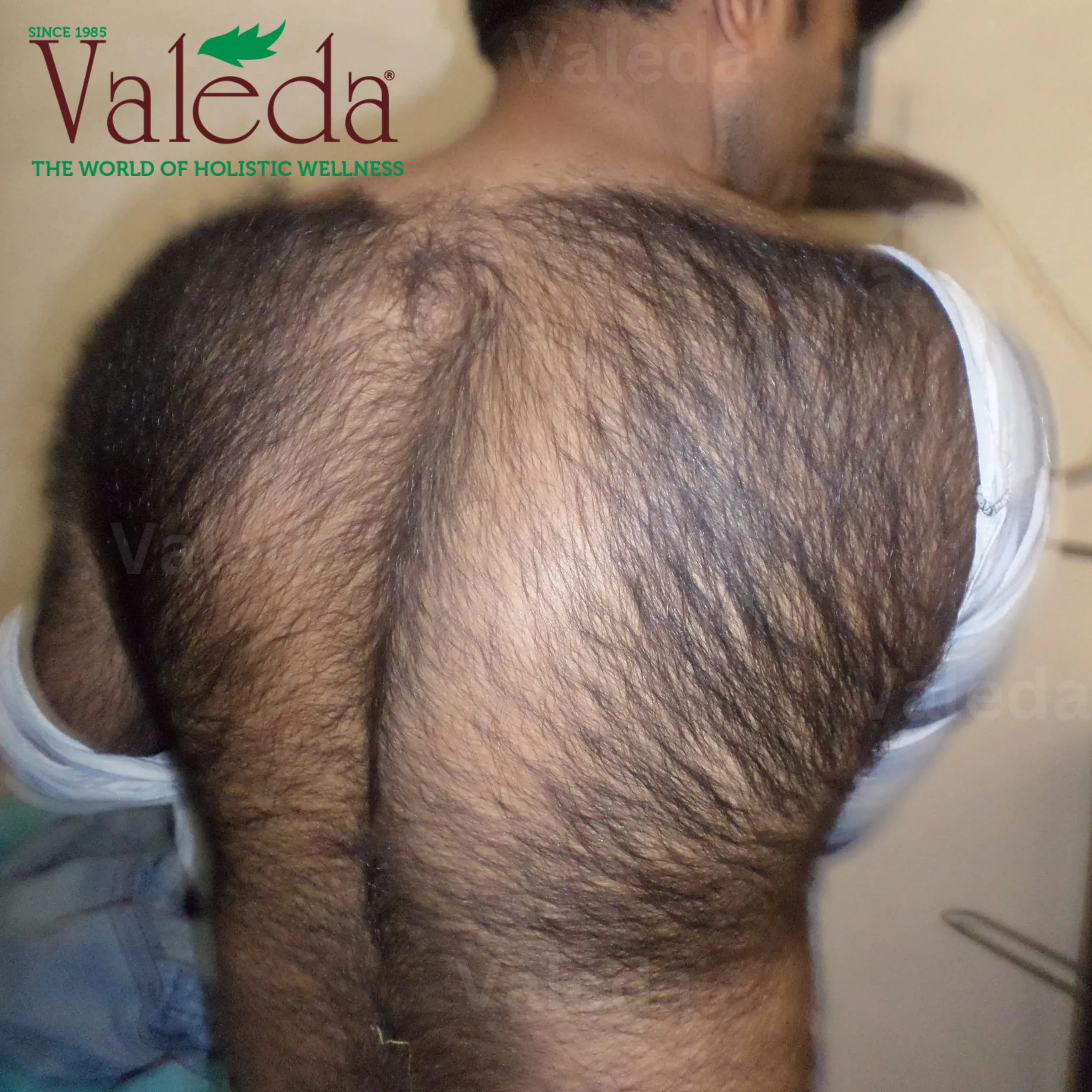 Clinical photograph 4