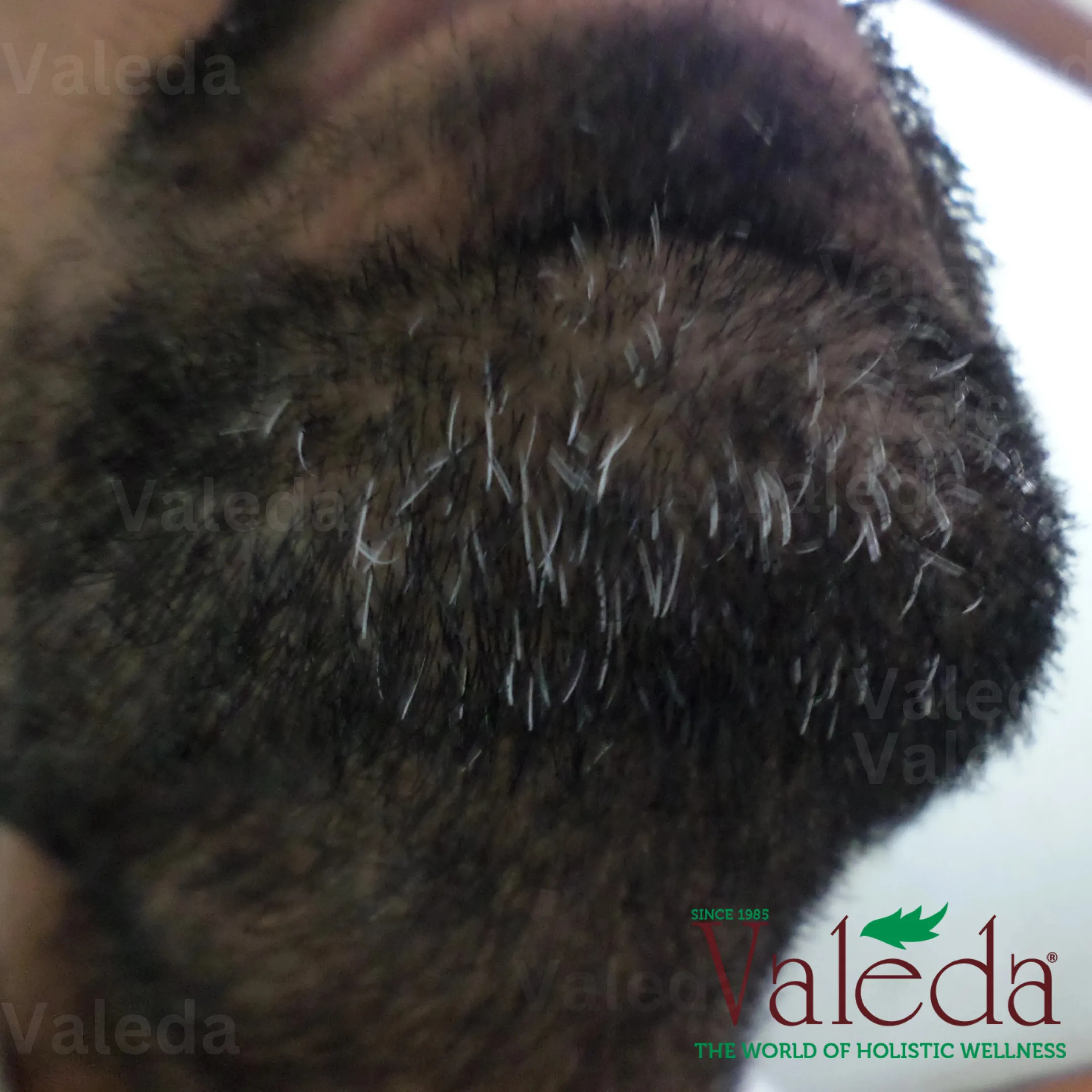 Clinical photograph 5