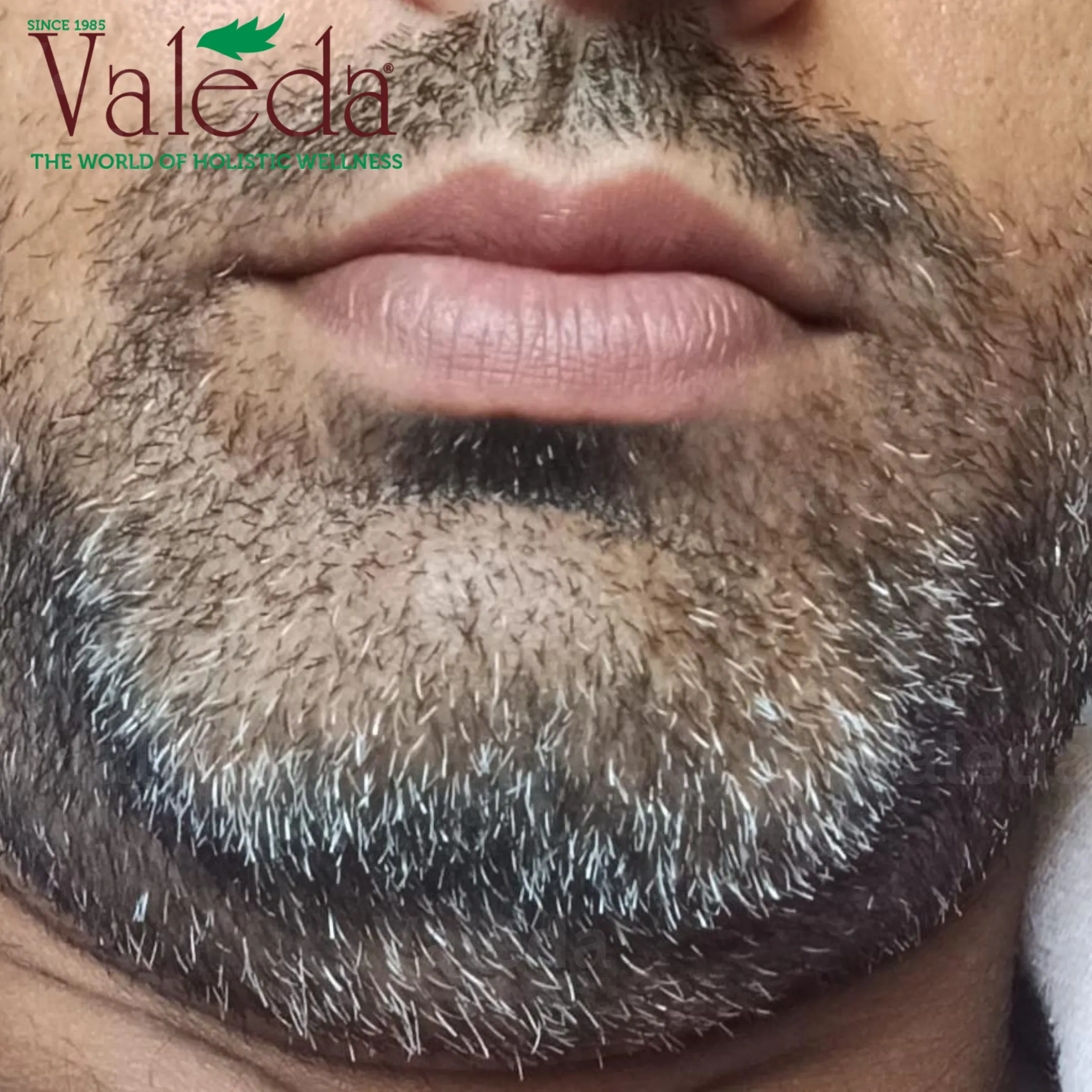 Clinical photograph 7