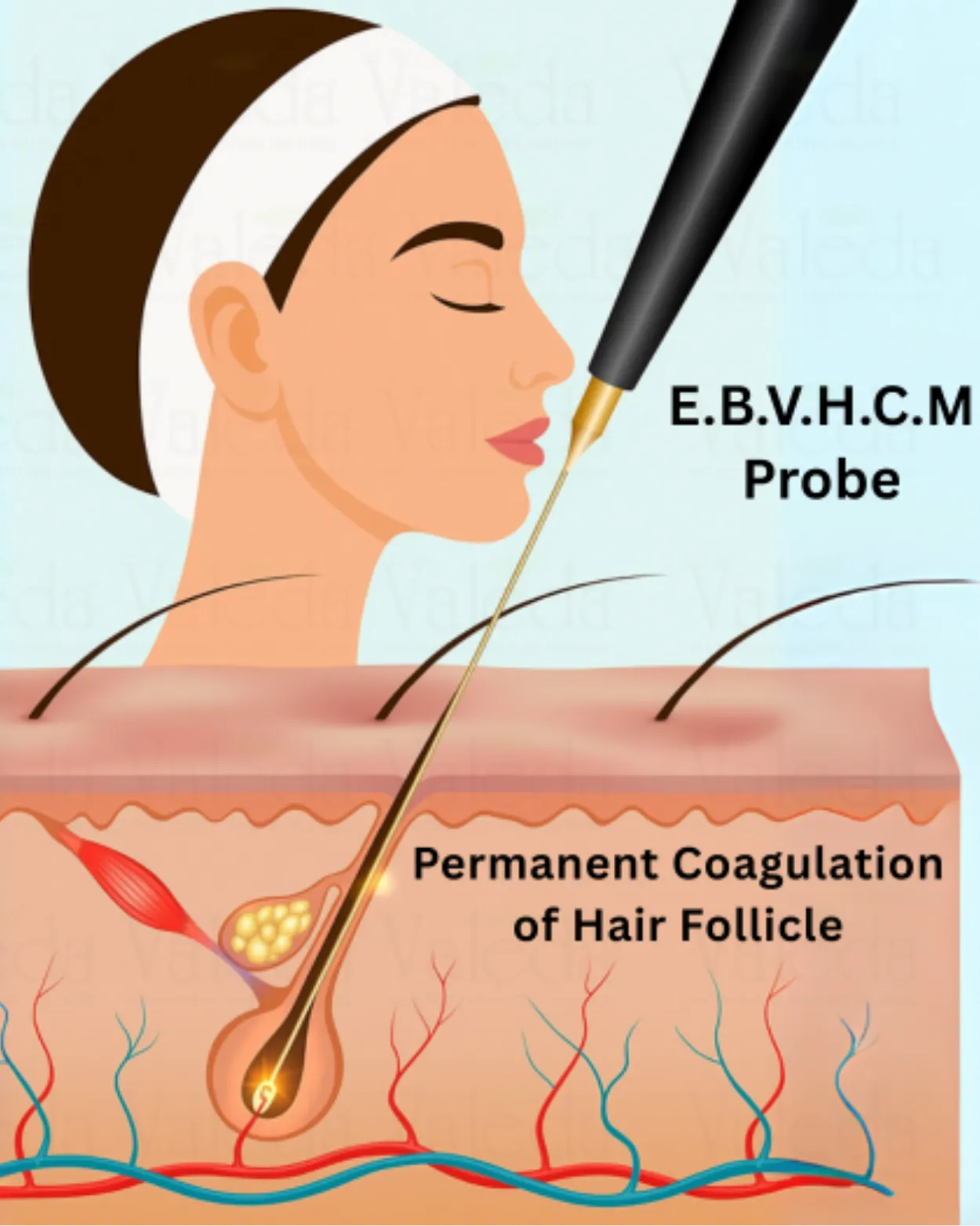 Permanent Hair Removal Blogs