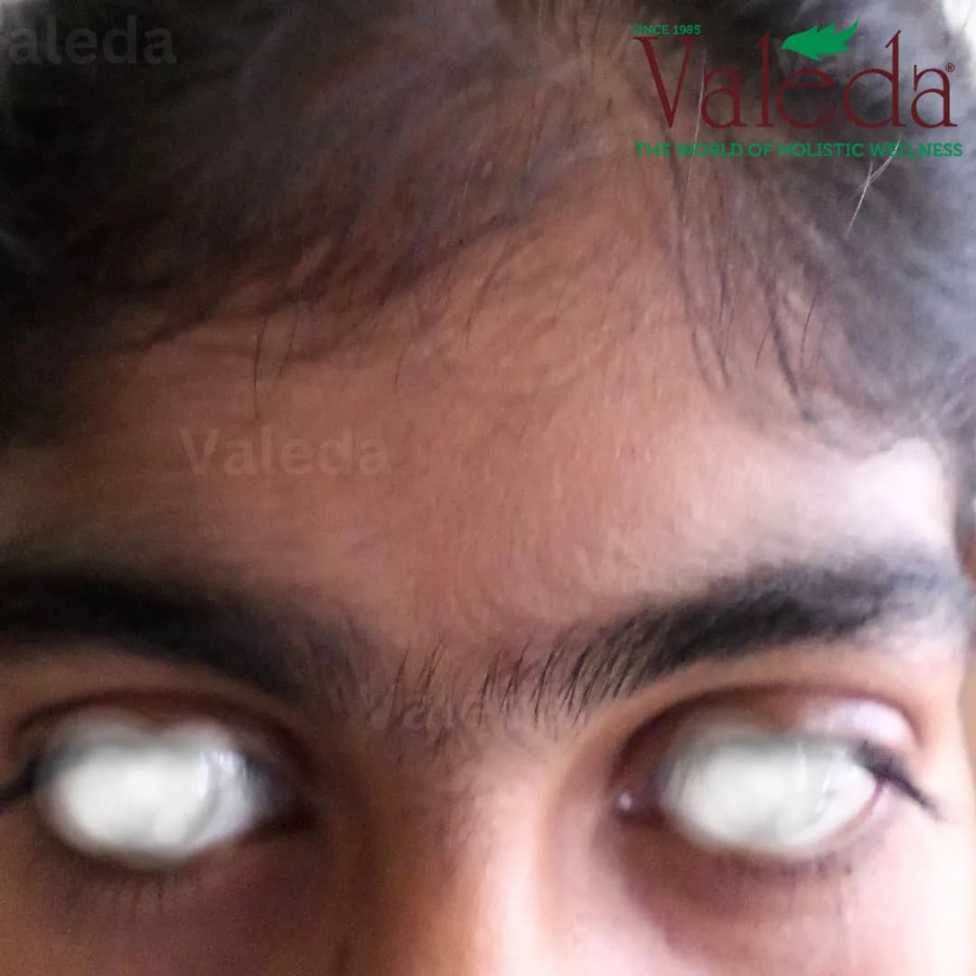Clinical photograph 9