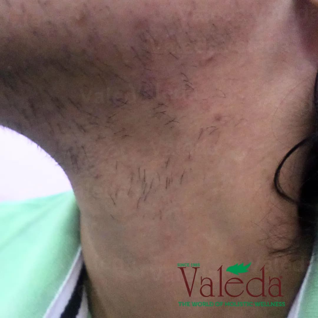 Clinical photograph 14