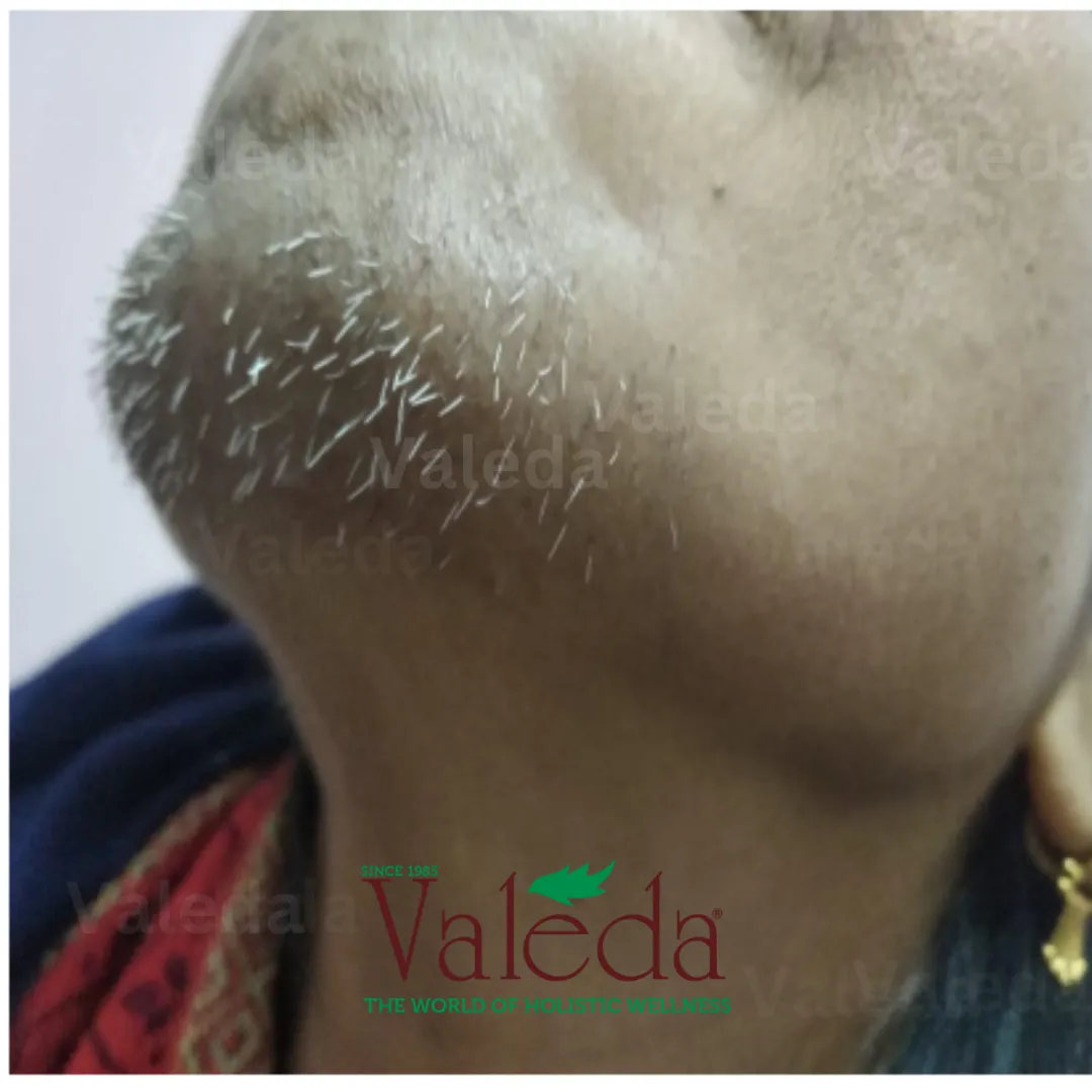 Clinical photograph 4
