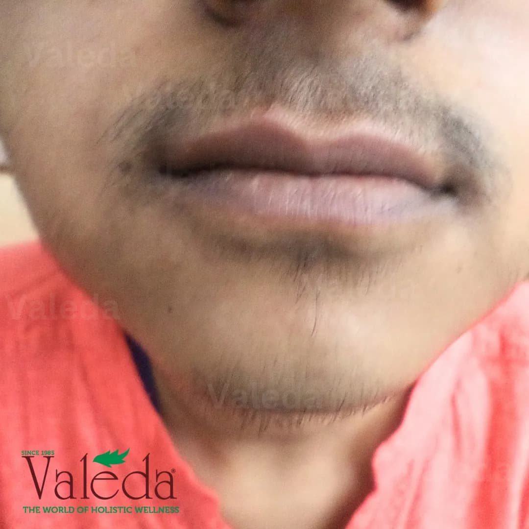 Clinical photograph 5