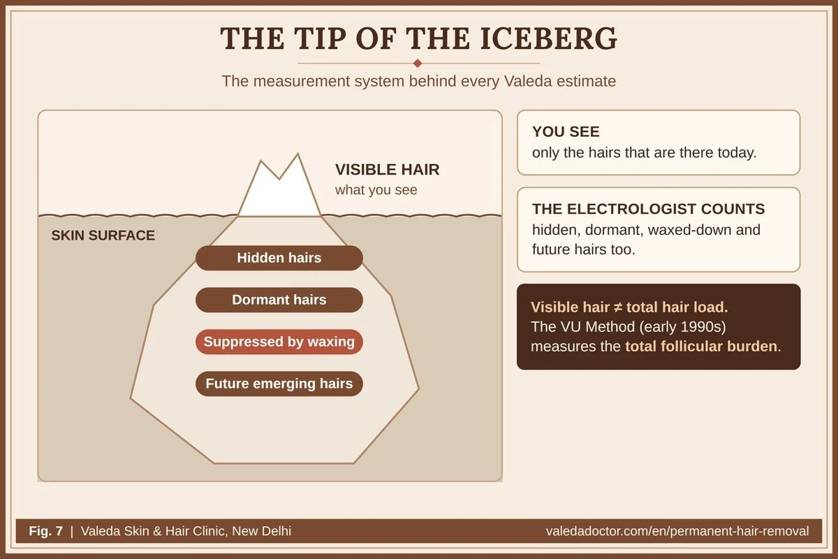 दिखाई देने वाले बाल हिमखंड का केवल सिरा हैं; छिपे, निष्क्रिय, दबे और भविष्य के बाल कुल रोमकूप भार बनाते हैं