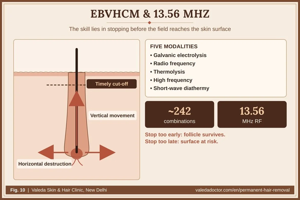 EBVHCM की पाँच विधियाँ, लगभग 242 संयोजन और 13.56 MHz रेडियो फ्रीक्वेंसी; क्षैतिज व ऊर्ध्वाधर विनाश क्षेत्र और सही समय पर रोकना