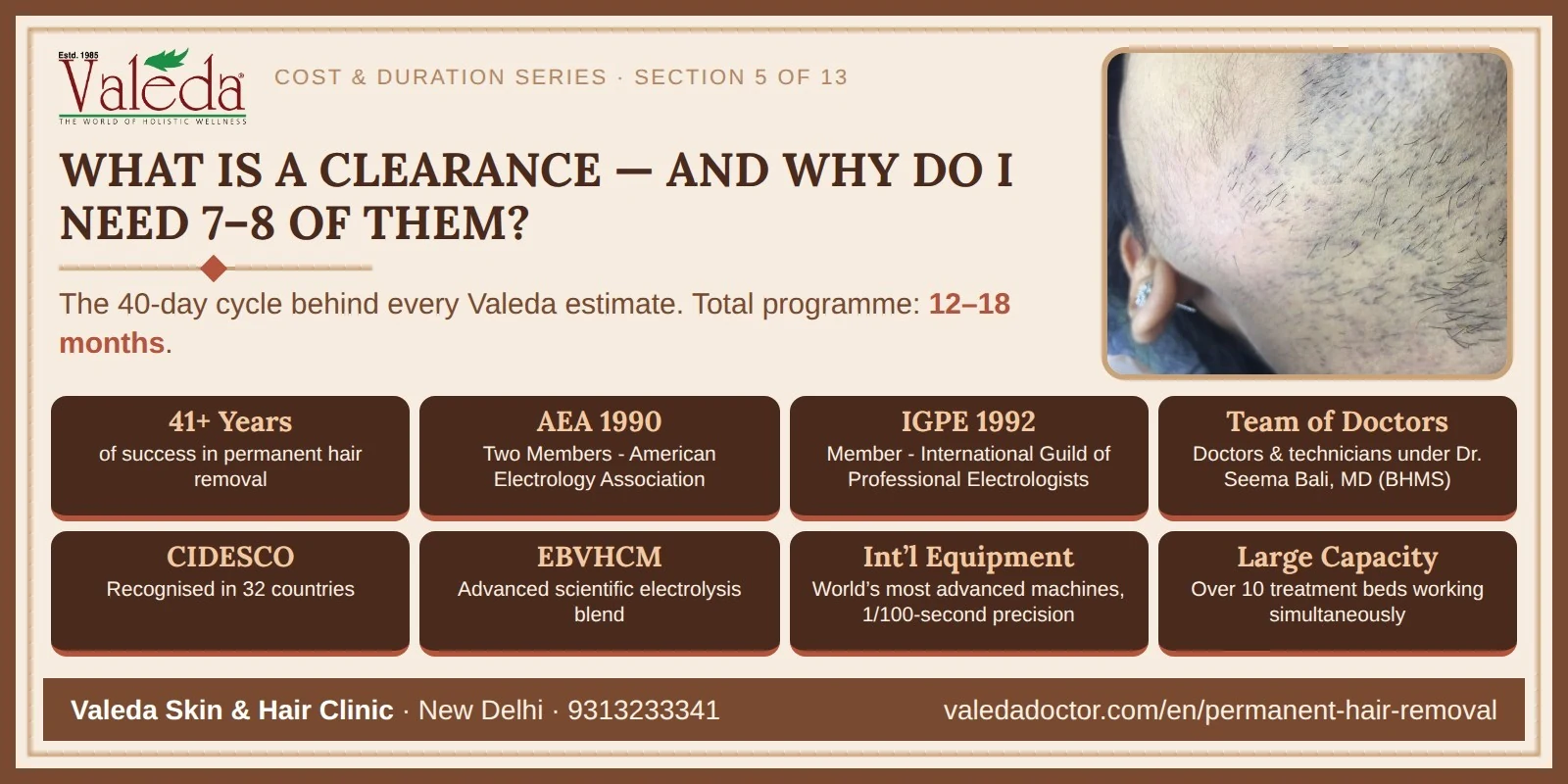 Section 5 — Understanding Clearance: The 40-Day Biological Cycle, and Why 7–8 Clearances Over 12–18 Months Are Usually Required