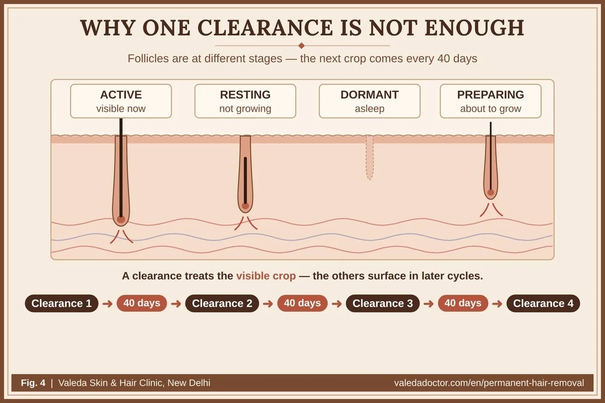 Why one clearance does not complete treatment: follicles are active, resting, dormant or preparing to grow; each 40-day cycle brings the next crop