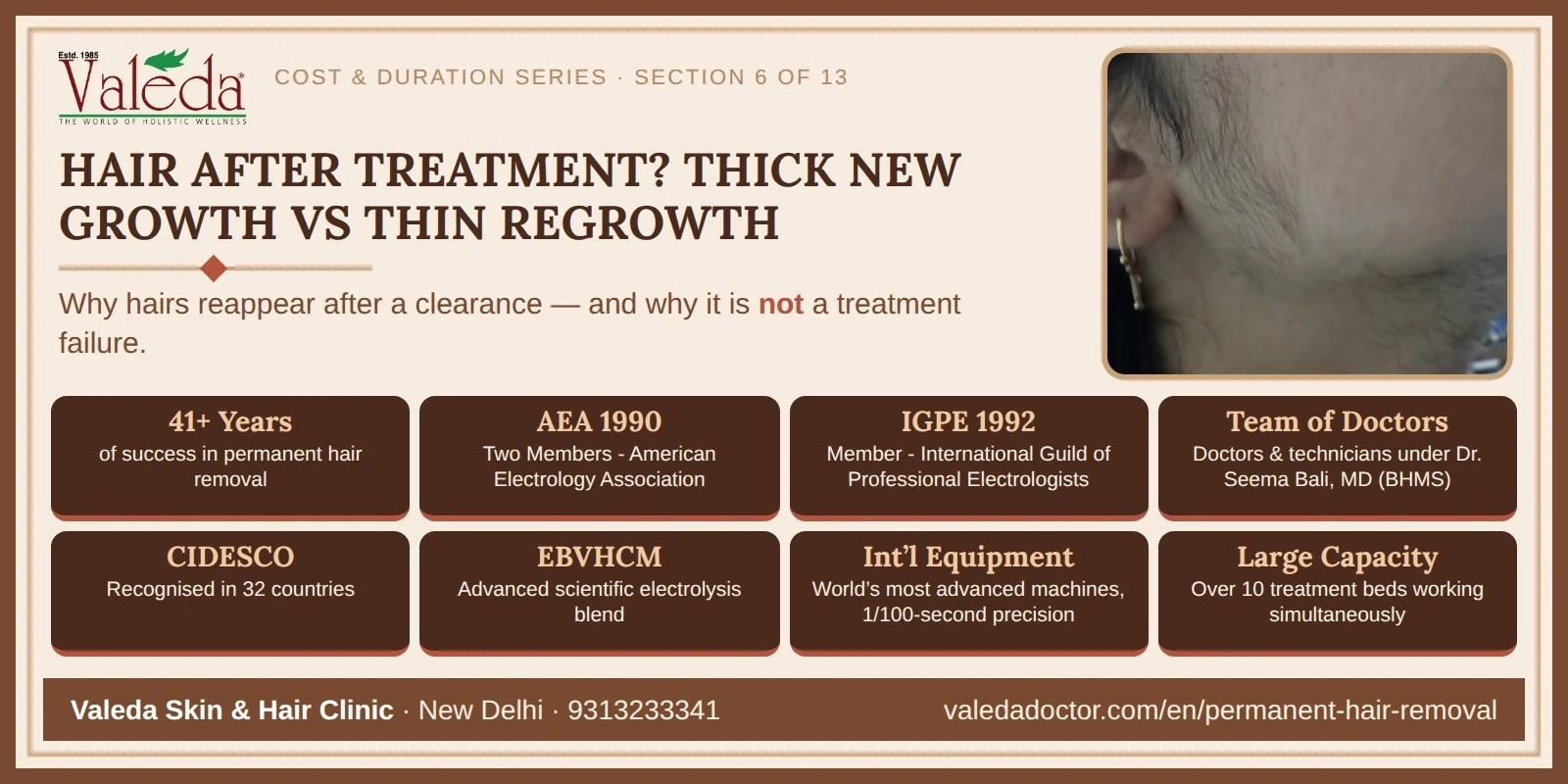 Section 6 — Thick New Growth vs Thin Regrowth: Why Hairs Continue to Appear After a Successful Clearance