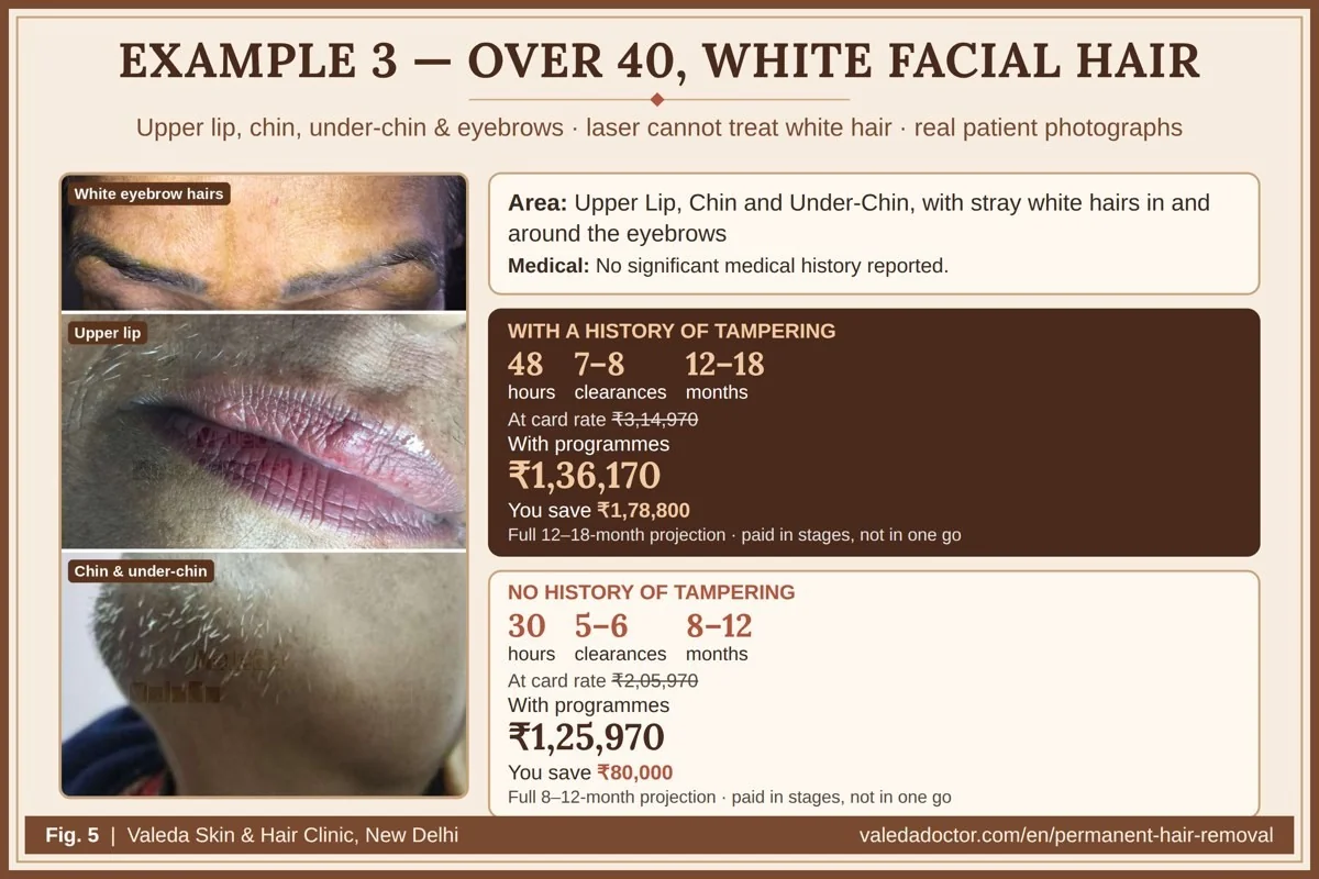 Real patient photograph for Example 3 (Over 40 — white facial hair) with hours, months and estimated total budget