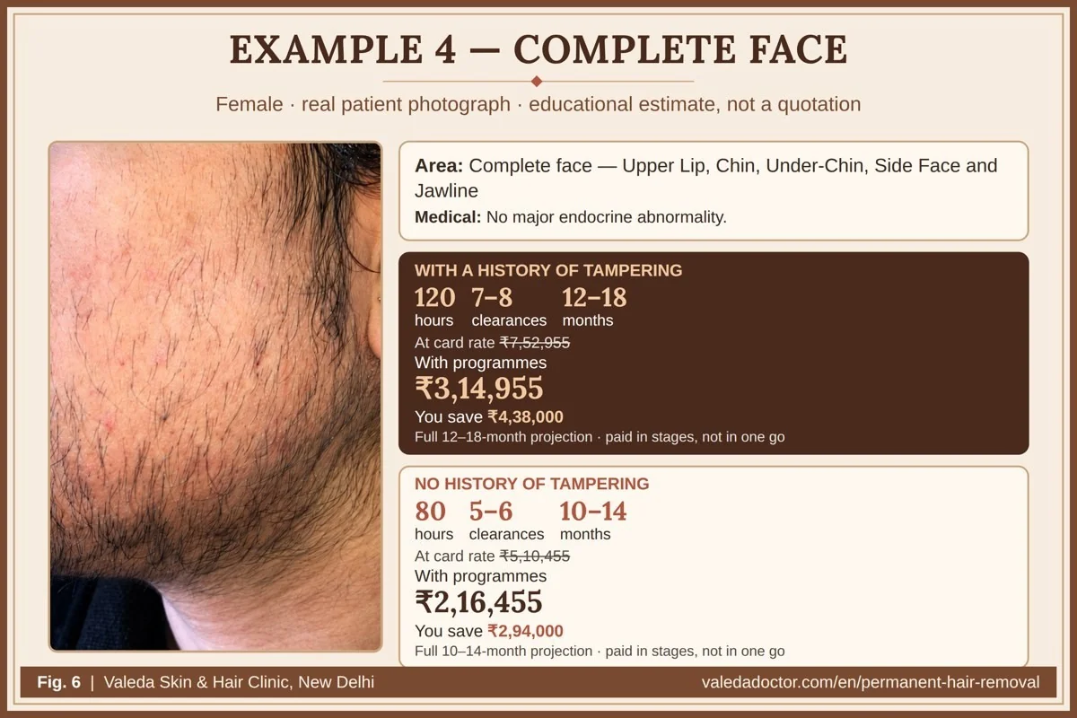 Real patient photograph for Example 4 (Complete face) with hours, months and estimated total budget