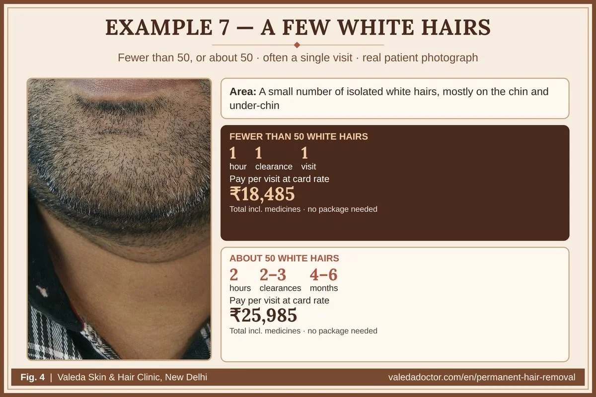 Real patient photograph for Example 7 (White beard — under 50 / about 50) with hours, clearances, months and budget