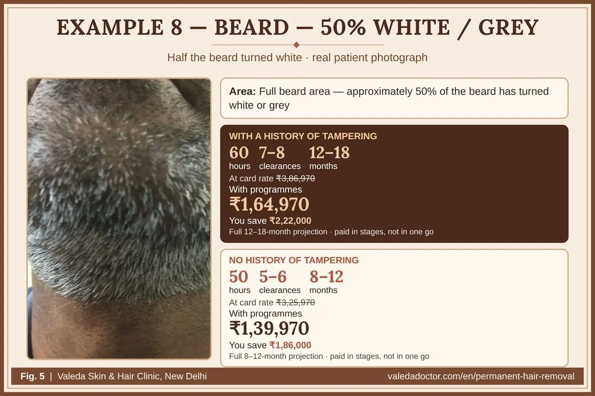 Real patient photograph for Example 8 (Beard — 50% white / grey) with hours, clearances, months and budget