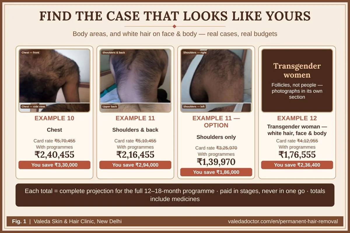 Real cases on this page — chest, shoulders and back, shoulders only, and a transgender woman with white hair on face and body — each with card-rate and programme budget