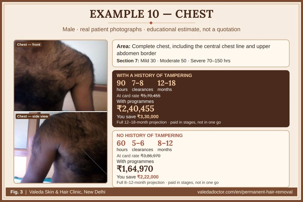 Real patient photographs for Example 10 (Chest) with hours, clearances, months and budget