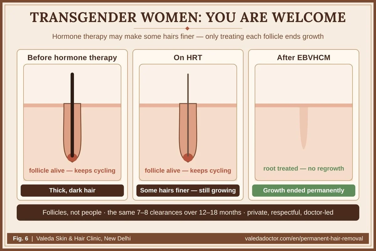 Hair growth cycle under gender-affirming hormone therapy: hormones may make some hairs finer, but the follicles remain alive and keep cycling; only treating each follicle ends it permanently