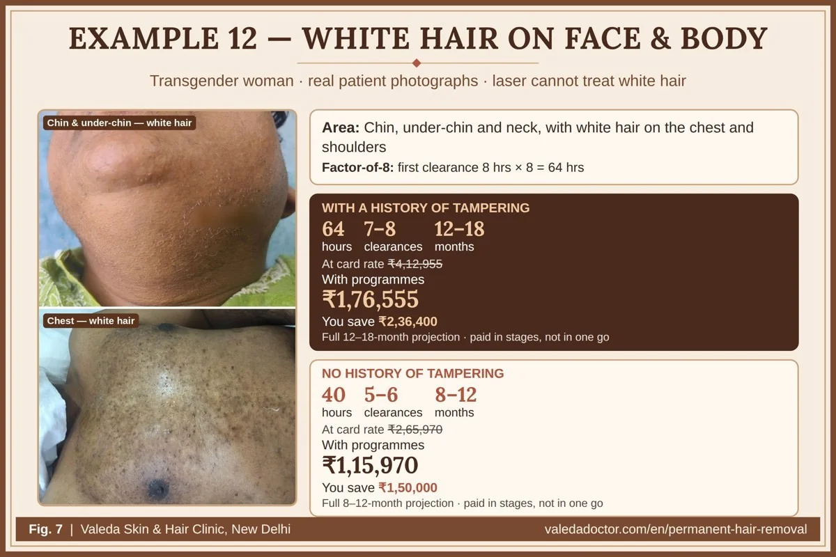 Real patient photographs for Example 12 — a transgender woman with white hair on the chin, under-chin and chest — with hours, clearances, months and budget